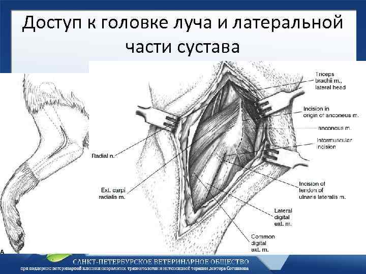 Доступ к головке луча и латеральной части сустава 