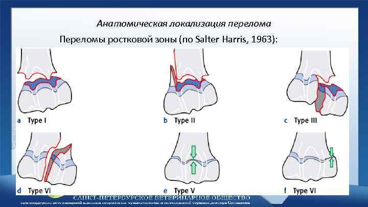 Перелом голеностопного сустава карта вызова скорой