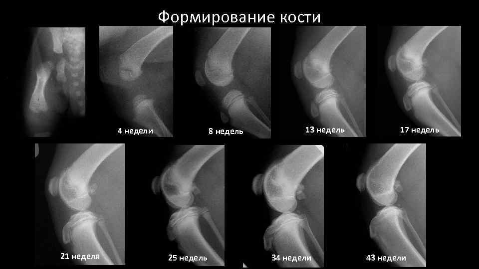 Формирование кости 4 недели 21 неделя 8 недель 25 недель 13 недель 34 недели