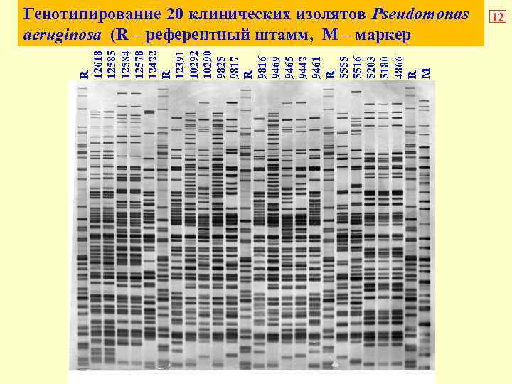 R 12618 12585 12584 12578 12422 R 12391 10292 10290 9825 9817 R 9816