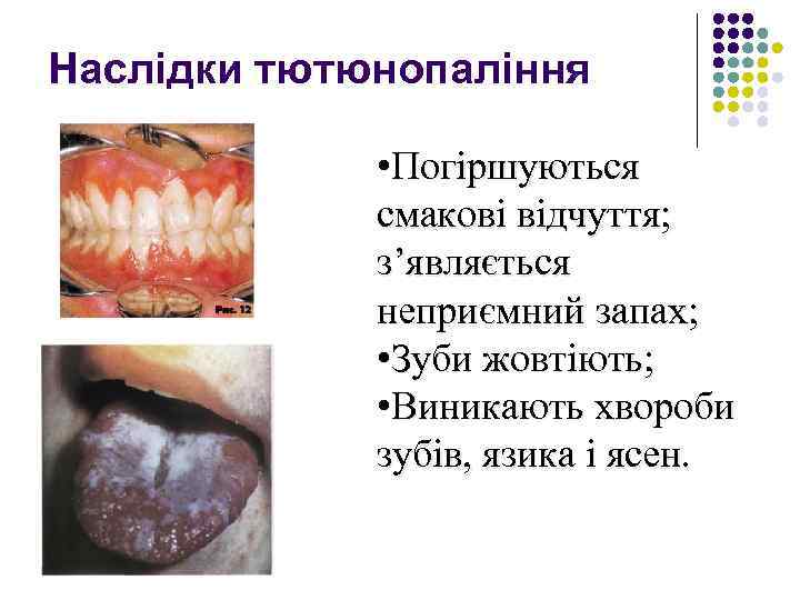 Наслідки тютюнопаління • Погіршуються смакові відчуття; з’являється неприємний запах; • Зуби жовтіють; • Виникають