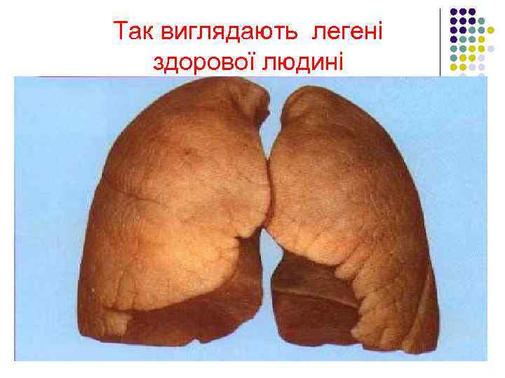 Так виглядають легені здорової людині 
