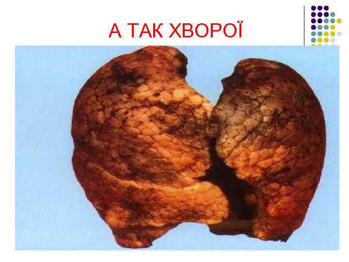 А ТАК ХВОРОЇ 