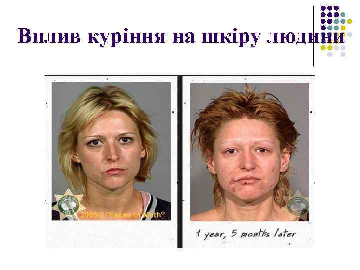 Вплив куріння на шкіру людини 