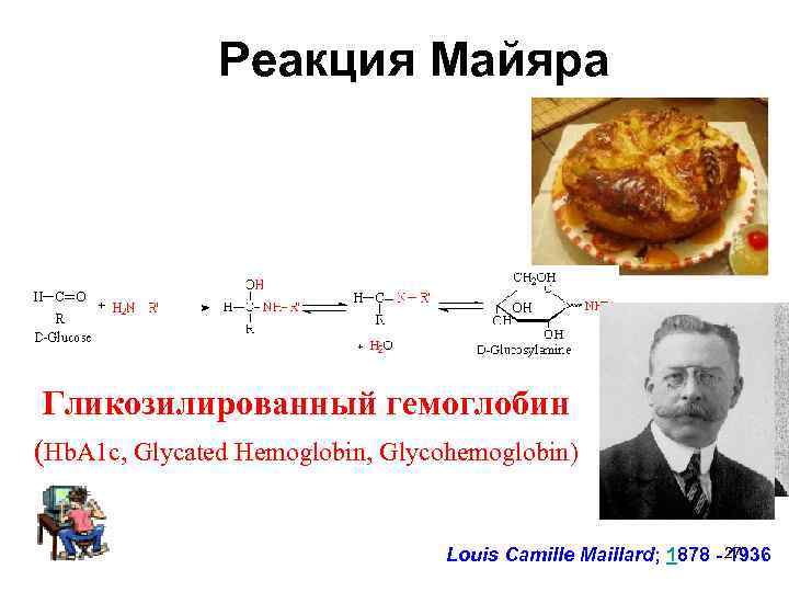 Реакция Майяра Гликозилированный гемоглобин (Hb. A 1 c, Glycated Hemoglobin, Glycohemoglobin) Louis Camille Maillard;