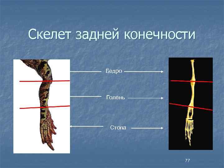 Скелет задней конечности Бедро Голень Стопа 77 