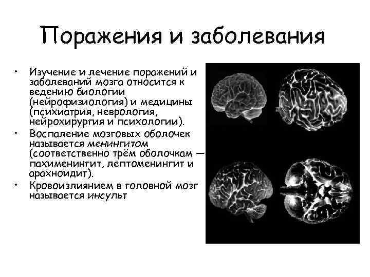 Поражения и заболевания • • • Изучение и лечение поражений и заболеваний мозга относится