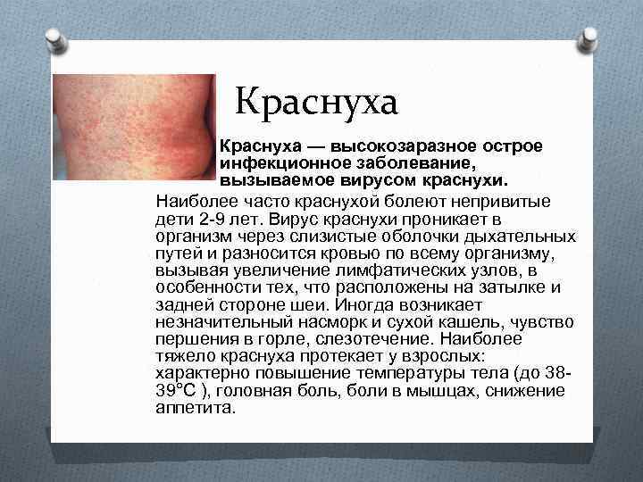 Краснуха — высокозаразное острое инфекционное заболевание, вызываемое вирусом краснухи. Наиболее часто краснухой болеют непривитые