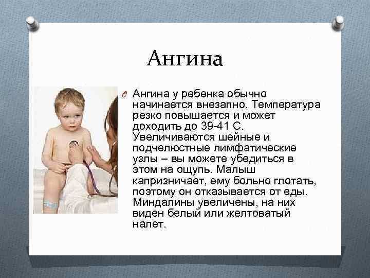 Ангина O Ангина у ребенка обычно начинается внезапно. Температура резко повышается и может доходить