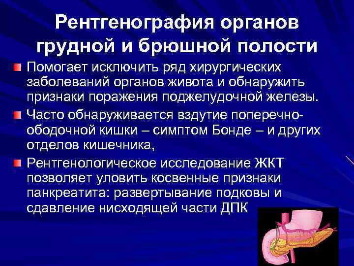 Рентгенография органов грудной и брюшной полости Помогает исключить ряд хирургических заболеваний органов живота и