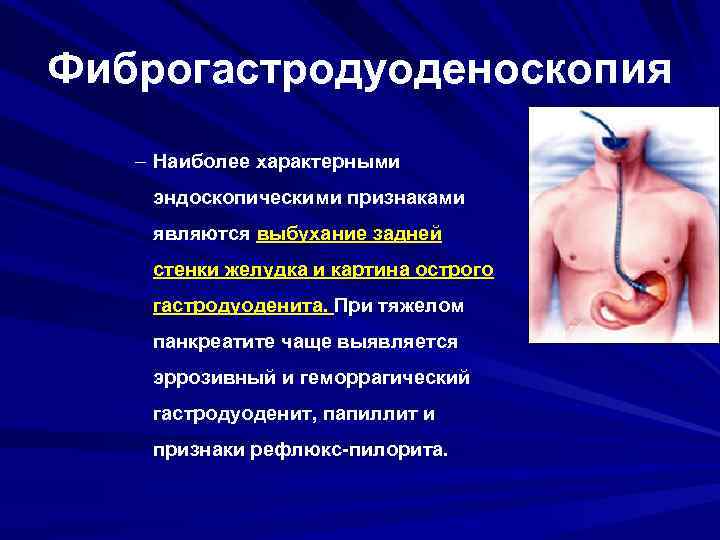 Фиброгастродуоденоскопия – Наиболее характерными эндоскопическими признаками являются выбухание задней стенки желудка и картина острого