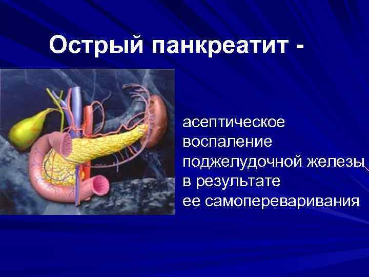 Острый панкреатит асептическое воспаление поджелудочной железы в результате ее самопереваривания 