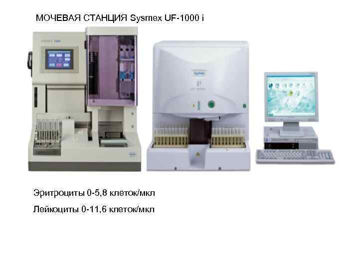 МОЧЕВАЯ СТАНЦИЯ Sysmex UF-1000 i Эритроциты 0 -5, 8 клеток/мкл Лейкоциты 0 -11, 6