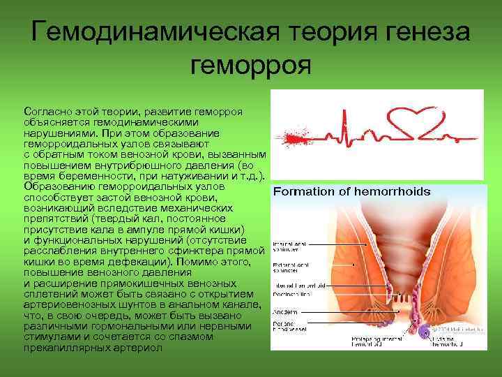 Гемодинамическая теория генеза геморроя Согласно этой теории, развитие геморроя объясняется гемодинамическими нарушениями. При этом