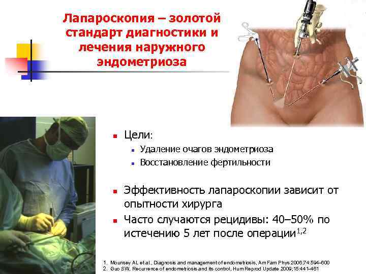 Лапароскопия – золотой стандарт диагностики и лечения наружного эндометриоза n Цели: n n Удаление