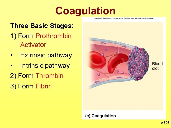 Coagulation Three Basic Stages: 1) Form Prothrombin Activator • Extrinsic pathway • Intrinsic pathway