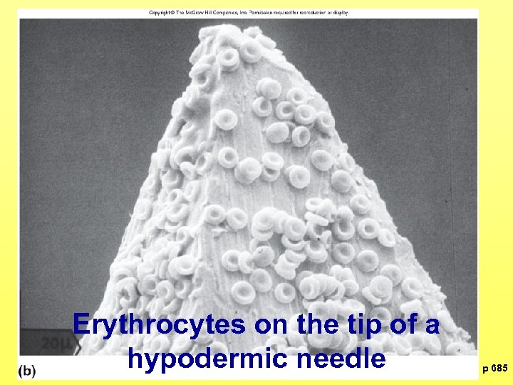 Erythrocytes on the tip of a hypodermic needle p 685 