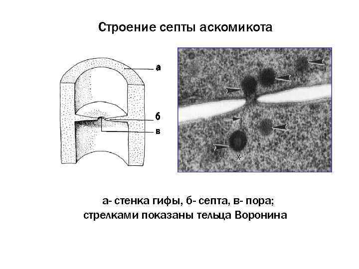 Строение септы аскомикота а б в а- стенка гифы, б- септа, в- пора; стрелками