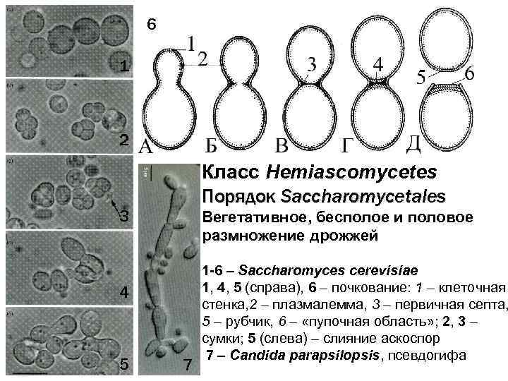 Рассмотрите изображение дрожжей какое свойство. Пекарские дрожжи Saccharomyces cerevisiae. Строение клетки дрожжи Saccharomyces cerevisiae. Дрожжи Saccharomyces cerevisiae строение. Клетка Saccharomyces схема.