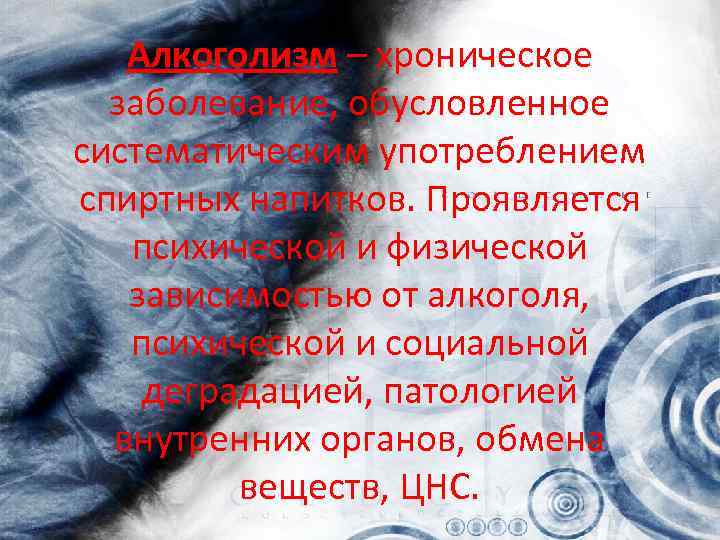 Алкоголизм – хроническое заболевание, обусловленное систематическим употреблением спиртных напитков. Проявляется психической и физической зависимостью