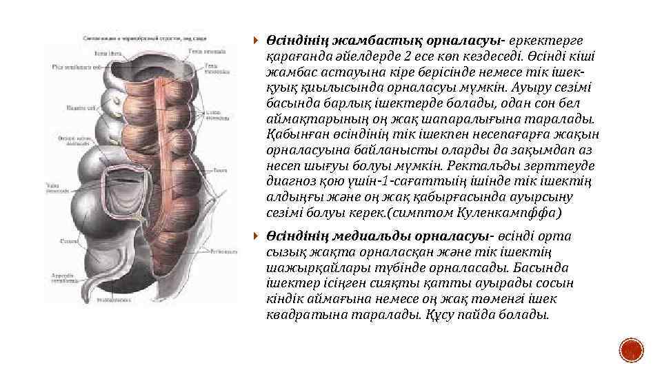  Өсіндінің жамбастық орналасуы- еркектерге қарағанда әйелдерде 2 есе көп кездеседі. Өсінді кіші жамбас