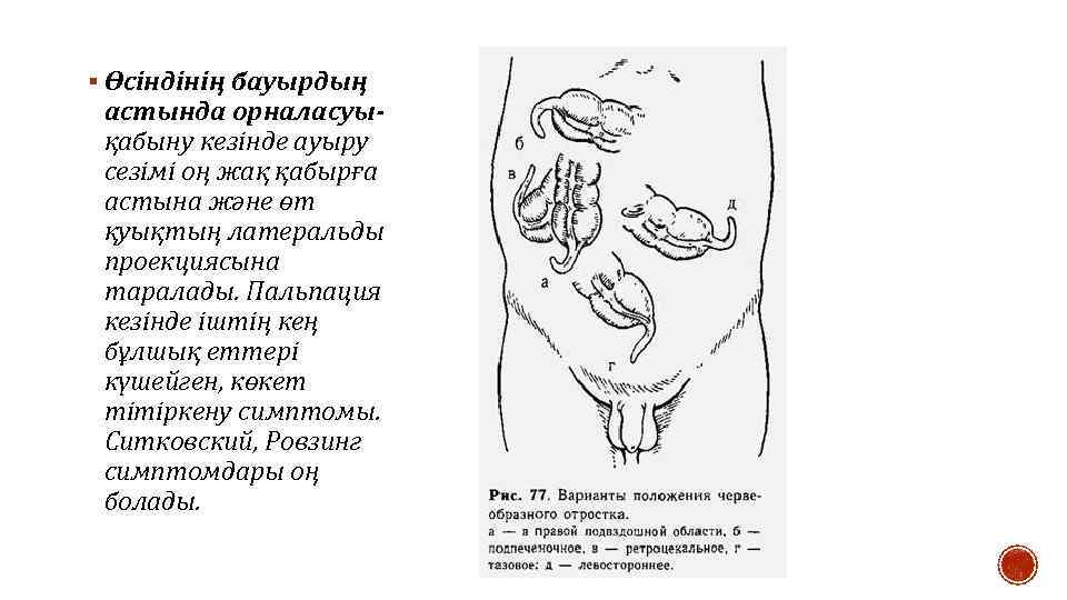 § Өсіндінің бауырдың астында орналасуықабыну кезінде ауыру сезімі оң жақ қабырға астына және өт