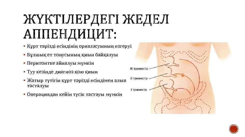 § Құрт тәрізді өсіндінің орналасуының өзгеруі § Бұлшық ет тонусының қиын байқалуы § Перитонтке