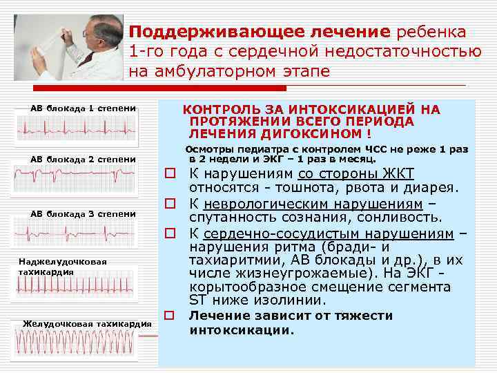 Поддерживающее лечение ребенка 1 -го года с сердечной недостаточностью на амбулаторном этапе АВ блокада