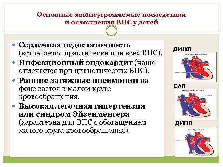 Порок сердца симптомы у взрослых