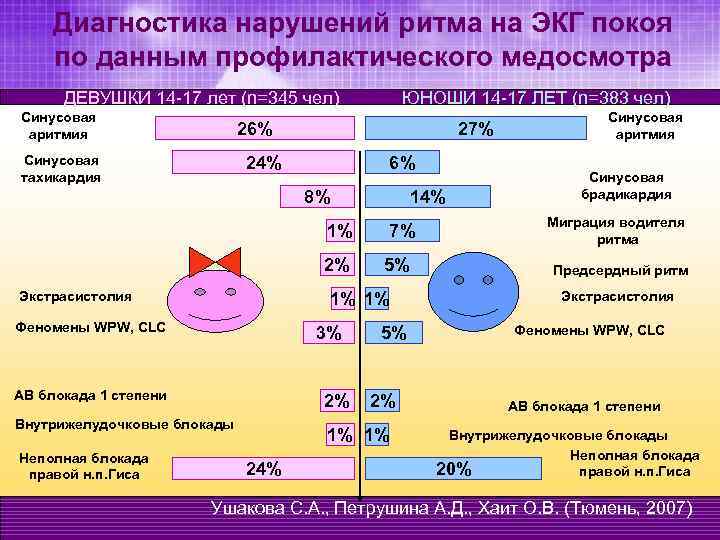 Диагностика нарушений ритма на ЭКГ покоя по данным профилактического медосмотра ДЕВУШКИ 14 -17 лет