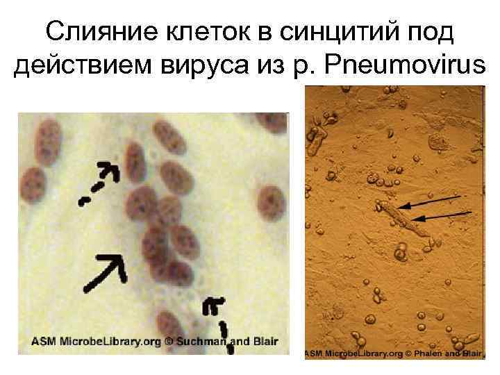 Слияние клеток в синцитий под действием вируса из p. Pneumovirus 