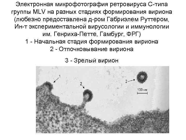 Электронная микрофотография ретровируса С-типа группы MLV на разных стадиях формирования вириона (любезно предоставлена д-ром