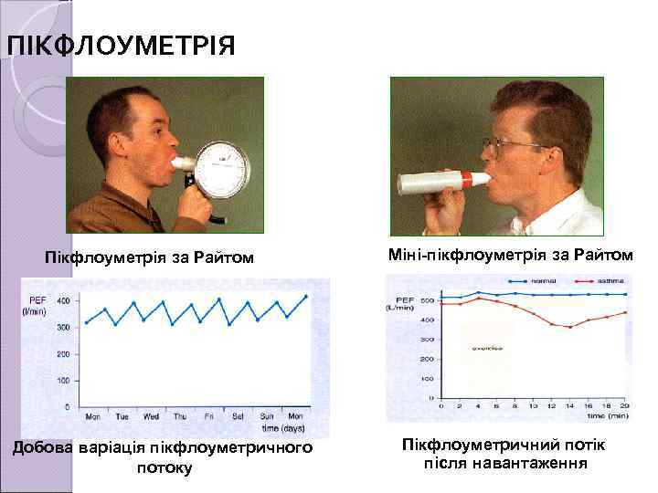 ПІКФЛОУМЕТРІЯ Пікфлоуметрія за Райтом Добова варіація пікфлоуметричного потоку Міні-пікфлоуметрія за Райтом Пікфлоуметричний потік після