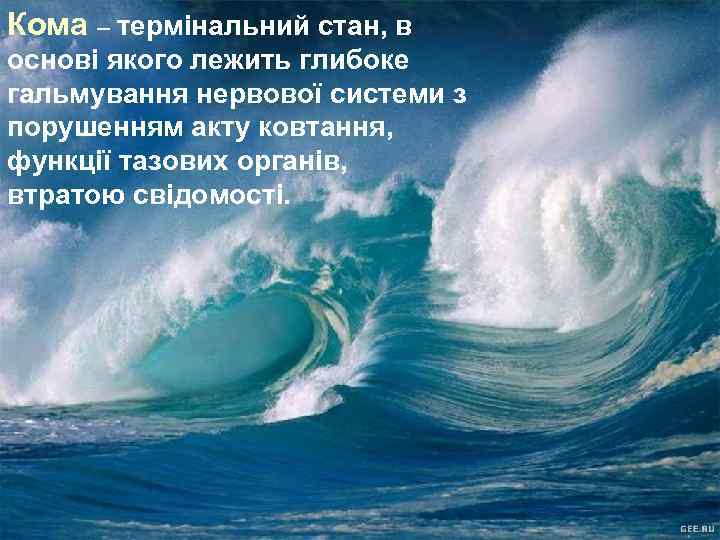 Кома – термінальний стан, в основі якого лежить глибоке гальмування нервової системи з порушенням