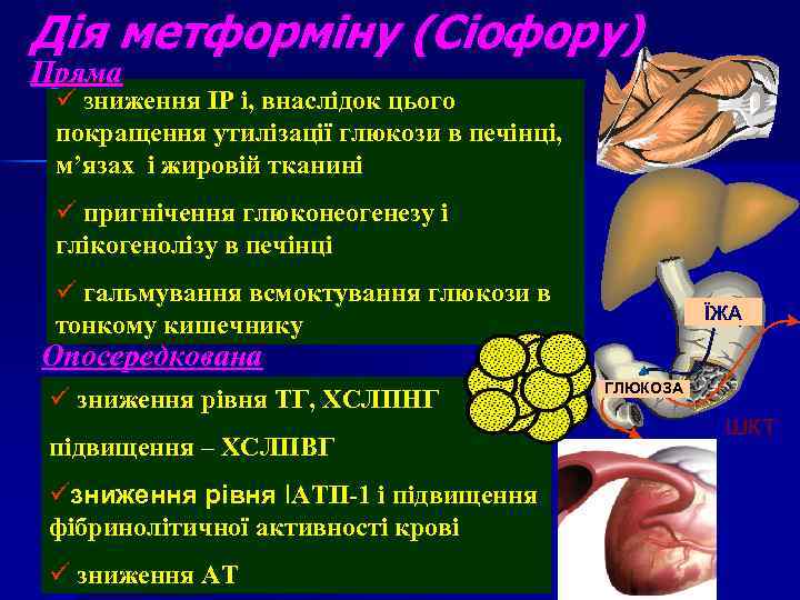 Дія метформіну (Сіофору) Пряма ü зниження ІР і, внаслідок цього покращення утилізації глюкози в