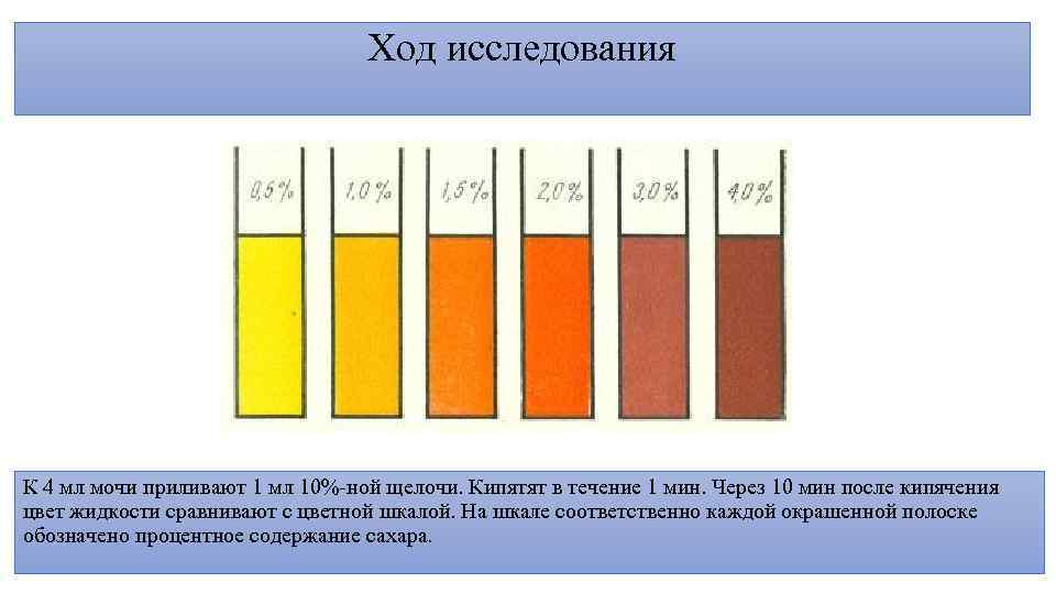 Ход исследования К 4 мл мочи приливают 1 мл 10%-ной щелочи. Кипятят в течение