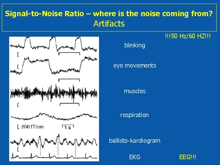 Signal-to-Noise Ratio – where is the noise coming from? Artifacts !!!50 Hz/60 HZ!!! blinking
