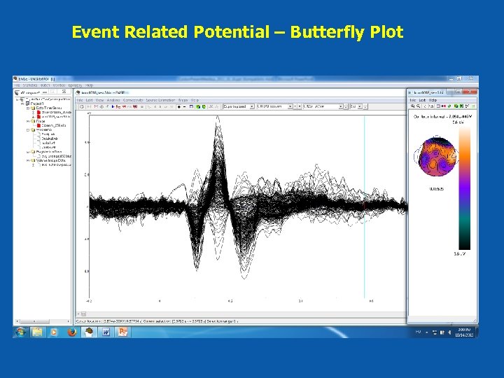 Event Related Potential – Butterfly Plot 