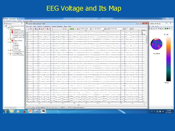 EEG Voltage and Its Map 