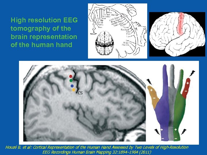 High resolution EEG tomography of the brain representation of the human hand Houzé B.