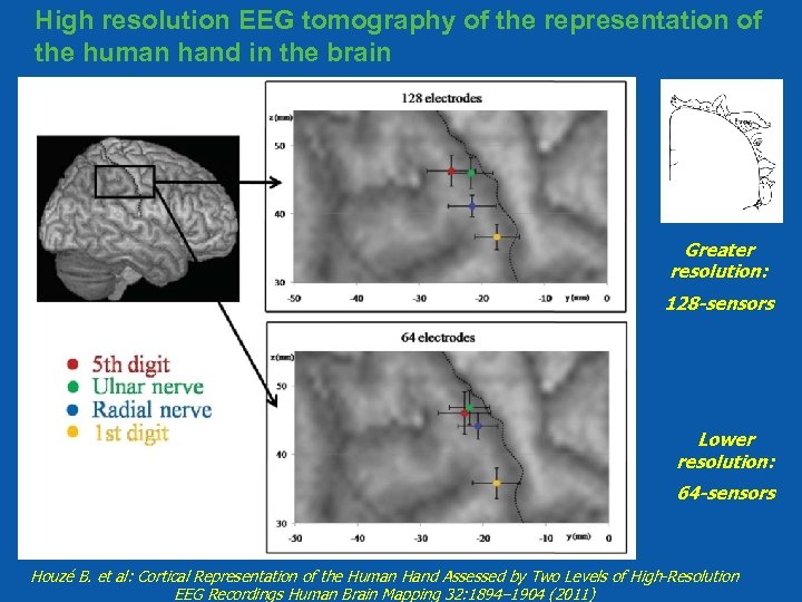 High resolution EEG tomography of the representation of the human hand in the brain