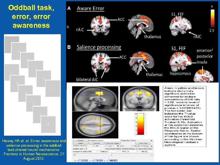 Oddball task, error awareness Harsay HA et. al: Errror awareness and salience processing in
