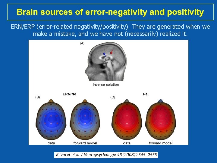 Brain sources of error-negativity and positivity ERN/ERP (error-related negativity/positivity). They are generated when we