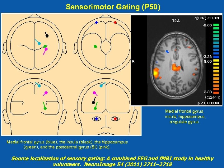 Sensorimotor Gating (P 50) Medial frontal gyrus, insula, hippocampus, cingulate gyrus. Medial frontal gyrus