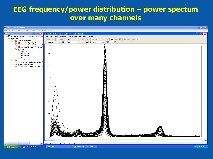 EEG frequency/power distribution – power spectum over many channels 
