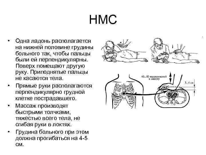 НМС • Одна ладонь располагается на нижней половине грудины больного так, чтобы пальцы были