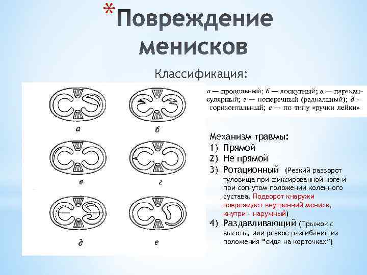 * Классификация: Механизм травмы: 1) Прямой 2) Не прямой 3) Ротационный (Резкий разворот 4)