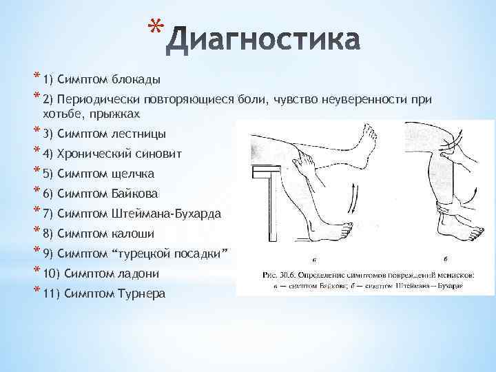 * * 1) Симптом блокады * 2) Периодически повторяющиеся боли, чувство неуверенности при хотьбе,