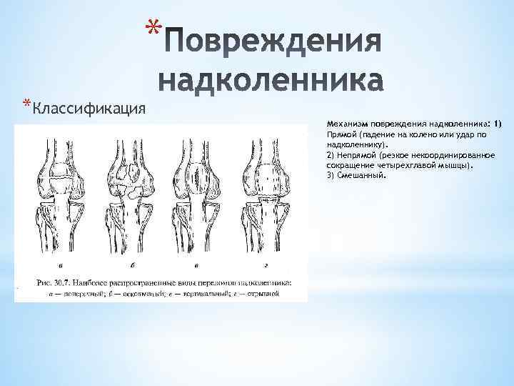 Перелом надколенника карта вызова