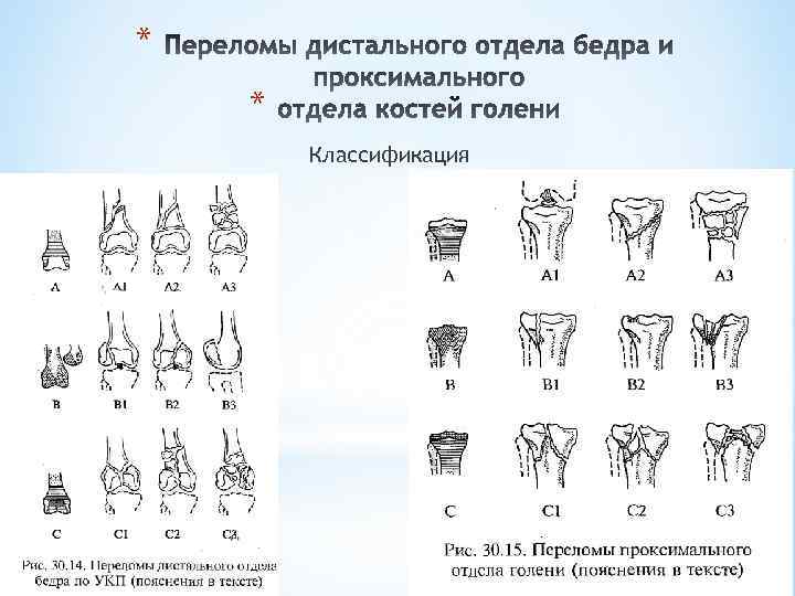 Переломы костей голени ответы нмо